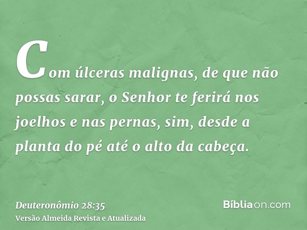 Com úlceras malignas, de que não possas sarar, o Senhor te ferirá nos joelhos e nas pernas, sim, desde a planta do pé até o alto da cabeça.