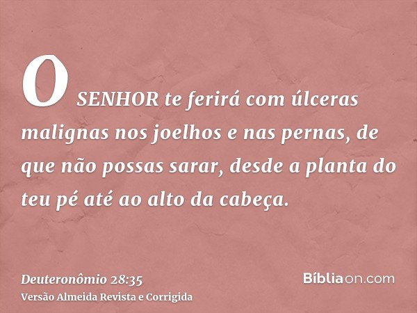 O SENHOR te ferirá com úlceras malignas nos joelhos e nas pernas, de que não possas sarar, desde a planta do teu pé até ao alto da cabeça.