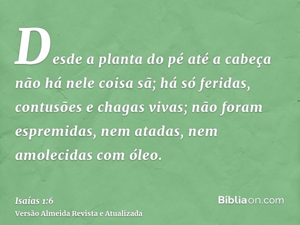 Desde a planta do pé até a cabeça não há nele coisa sã; há só feridas, contusões e chagas vivas; não foram espremidas, nem atadas, nem amolecidas com óleo.