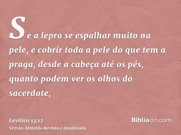 Se a lepra se espalhar muito na pele, e cobrir toda a pele do que tem a praga, desde a cabeça até os pés, quanto podem ver os olhos do sacerdote,